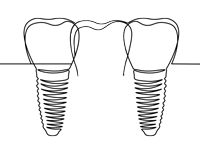 Dental Implant Bridge Icon